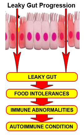 leaky-gut-progression