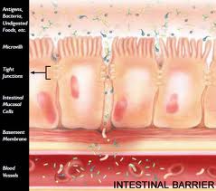 intestinal-barrier