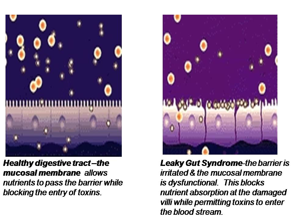 LEAKY-GUT-SYNDROME-HEALTHY-UNHEALTHY-EPITHELIAL-CELLS