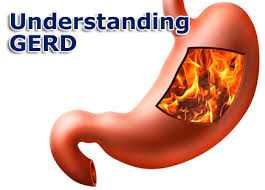understanding-gerd