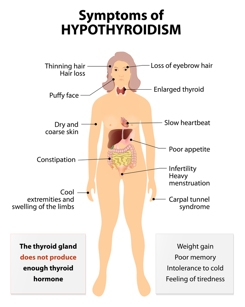 can-hypothyroidism-cause-diabetes